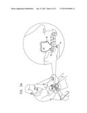 IMPLANT SYSTEMS WITH SWIVEL JOINTS FOR SINUS LIFT AND BONE AUGMENTATION diagram and image