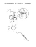 IMPLANT SYSTEMS WITH SWIVEL JOINTS FOR SINUS LIFT AND BONE AUGMENTATION diagram and image