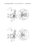 IMPLANT SYSTEMS WITH SWIVEL JOINTS FOR SINUS LIFT AND BONE AUGMENTATION diagram and image