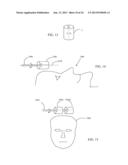 SYSTEMS AND METHODS FOR NEURO-EEG SYNCHRONIZATION THERAPY diagram and image