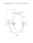 SYSTEMS AND METHODS FOR NEURO-EEG SYNCHRONIZATION THERAPY diagram and image