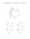 SYSTEMS AND METHODS FOR NEURO-EEG SYNCHRONIZATION THERAPY diagram and image