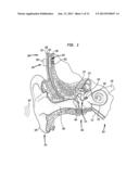 IMPLANTABLE COMPONENT OF A HEARING PROSTHESIS diagram and image