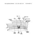 IMPLANTABLE COMPONENT OF A HEARING PROSTHESIS diagram and image