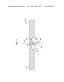 IMPLANTABLE COMPONENT OF A HEARING PROSTHESIS diagram and image