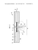 IMPLANTABLE COMPONENT OF A HEARING PROSTHESIS diagram and image