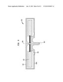 IMPLANTABLE COMPONENT OF A HEARING PROSTHESIS diagram and image