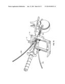 SURGICAL ACCESS SYSTEM AND RELATED METHODS diagram and image