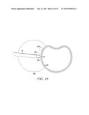 SURGICAL ACCESS SYSTEM AND RELATED METHODS diagram and image