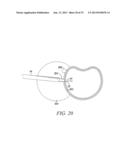 SURGICAL ACCESS SYSTEM AND RELATED METHODS diagram and image