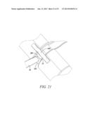 SURGICAL ACCESS SYSTEM AND RELATED METHODS diagram and image