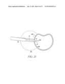 SURGICAL ACCESS SYSTEM AND RELATED METHODS diagram and image