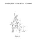 SURGICAL ACCESS SYSTEM AND RELATED METHODS diagram and image