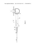 System and Methods For Performing Surgical Procedures and Assessments diagram and image