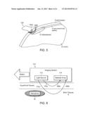 METHOD FOR DETECTING HEMATOMA, PORTABLE DETECTION AND DISCRIMINATION     DEVICE AND RELATED SYSTEMS AND APPARATUSES diagram and image