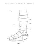 SYSTEMS, DEVICES, AND METHODS FOR PROVIDING FOOT LOADING FEEDBACK TO     PATIENTS AND PHYSICIANS DURING A PERIOD OF PARTIAL WEIGHT BEARING diagram and image