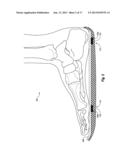 SYSTEMS, DEVICES, AND METHODS FOR PROVIDING FOOT LOADING FEEDBACK TO     PATIENTS AND PHYSICIANS DURING A PERIOD OF PARTIAL WEIGHT BEARING diagram and image