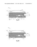 SYSTEMS, DEVICES, AND METHODS FOR PROVIDING FOOT LOADING FEEDBACK TO     PATIENTS AND PHYSICIANS DURING A PERIOD OF PARTIAL WEIGHT BEARING diagram and image