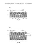 SYSTEMS, DEVICES, AND METHODS FOR PROVIDING FOOT LOADING FEEDBACK TO     PATIENTS AND PHYSICIANS DURING A PERIOD OF PARTIAL WEIGHT BEARING diagram and image