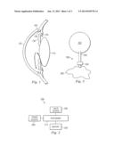 Separation of Gas and Liquid in Membrane Valves diagram and image