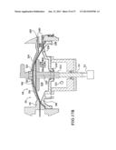 AUTOMATED DIALYSIS SYSTEM USING PISTON AND NEGATIVE PRESSURE diagram and image