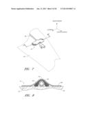 MEDICAL DEVICE SECUREMENT SYSTEM diagram and image