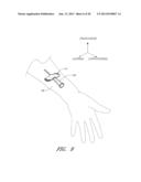 MEDICAL DEVICE SECUREMENT SYSTEM diagram and image