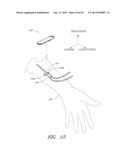 MEDICAL DEVICE SECUREMENT SYSTEM diagram and image