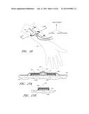 MEDICAL DEVICE SECUREMENT SYSTEM diagram and image