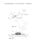 MEDICAL DEVICE SECUREMENT SYSTEM diagram and image