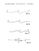 TISSUE MODIFICATION DEVICES AND METHODS diagram and image