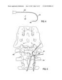 TISSUE MODIFICATION DEVICES AND METHODS diagram and image