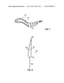 TISSUE MODIFICATION DEVICES AND METHODS diagram and image