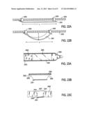 TISSUE MODIFICATION DEVICES AND METHODS diagram and image