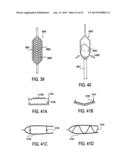 TISSUE MODIFICATION DEVICES AND METHODS diagram and image