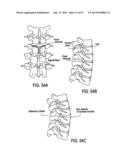 TISSUE MODIFICATION DEVICES AND METHODS diagram and image