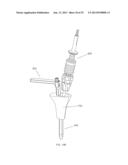 SURGICAL REAMING INSTRUMENT FOR SHAPING A BONE CAVITY diagram and image