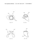 SURGICAL REAMING INSTRUMENT FOR SHAPING A BONE CAVITY diagram and image