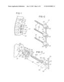 CAPLESS MULTIAXIAL SCREW AND SPINAL FIXATION ASSEMBLY AND METHOD diagram and image