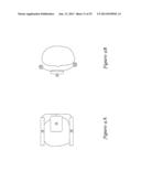 SUBCUTANEOUS DEFIBRILLATOR IMPLANTATION diagram and image