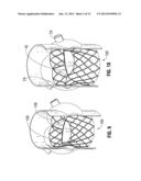 PROSTHETIC HEART VALVE HAVING IMPROVED COMMISSURE SUPPORTS diagram and image