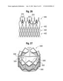 PROSTHETIC HEART VALVE HAVING IMPROVED COMMISSURE SUPPORTS diagram and image