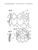 PROSTHETIC HEART VALVE HAVING IMPROVED COMMISSURE SUPPORTS diagram and image