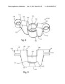 GLENOID VAULT FIXATION diagram and image