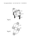 GLENOID VAULT FIXATION diagram and image