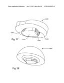 GLENOID VAULT FIXATION diagram and image