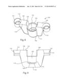 Shoulder Arthroplasty diagram and image