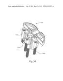 Shoulder Arthroplasty diagram and image