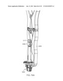 Shoulder Arthroplasty diagram and image