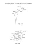 Shoulder Arthroplasty diagram and image